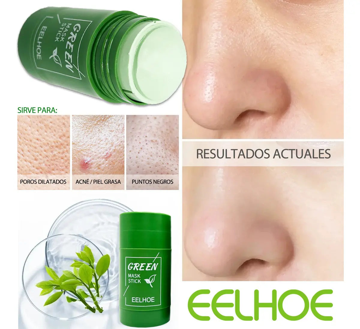 EELHOE™ - para una Piel Libre de Imperfecciones
