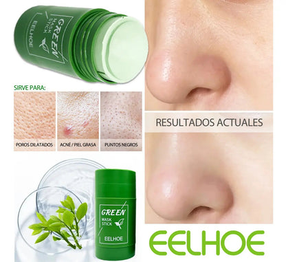 EELHOE™ - para una Piel Libre de Imperfecciones
